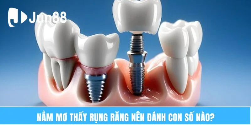 Nằm Mơ Thấy Rụng Răng Báo Hiệu Điều Gì? Tốt Hay Xấu? 7 Nằm mơ thấy rụng răng nên đánh con số nào?
